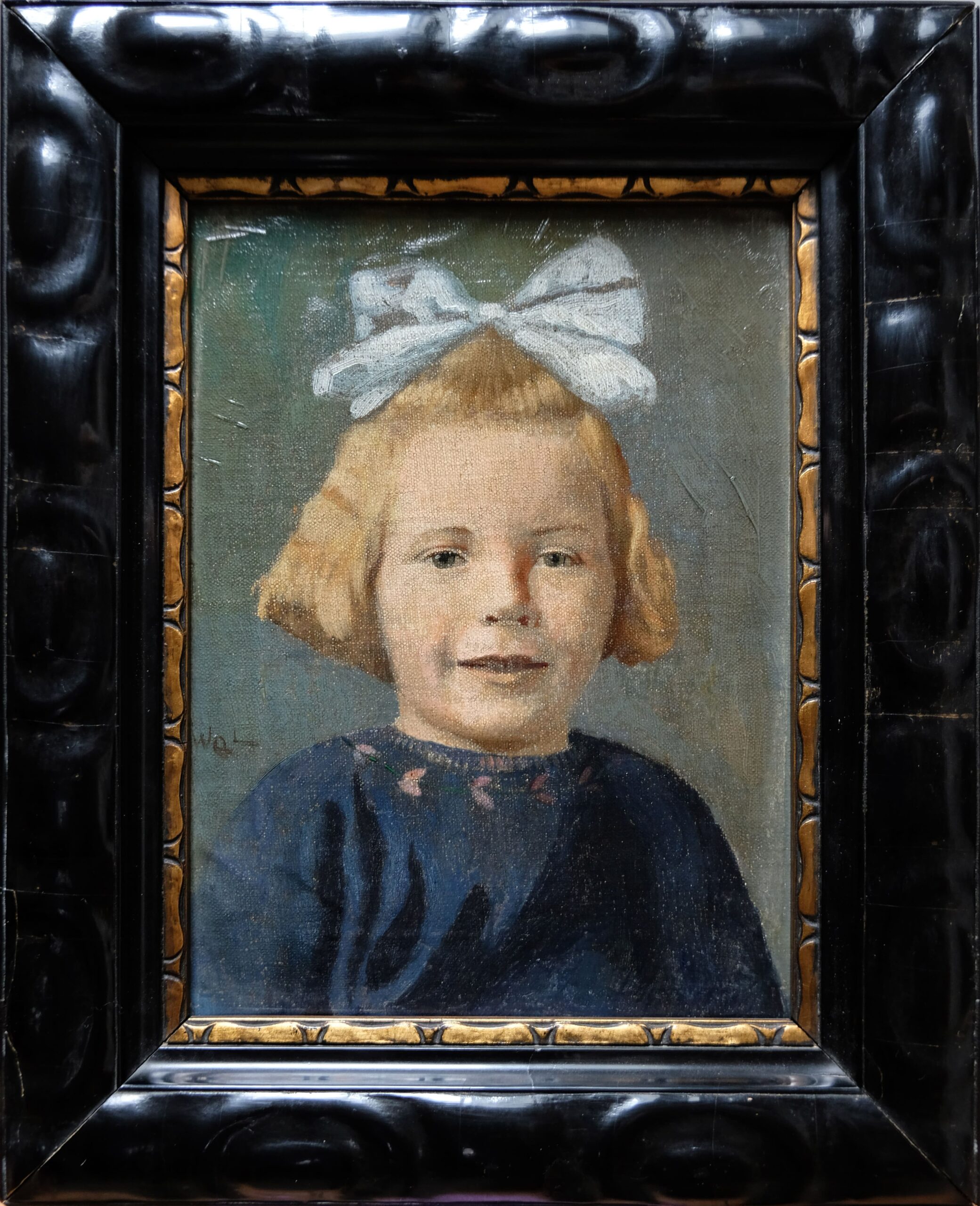 bambina fiocco dopo Dopo